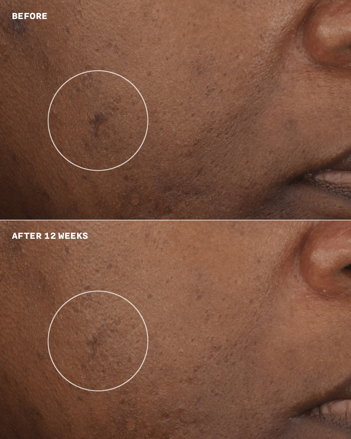 Clinique Even Better Clinical Brightening Moisturizer 50ml