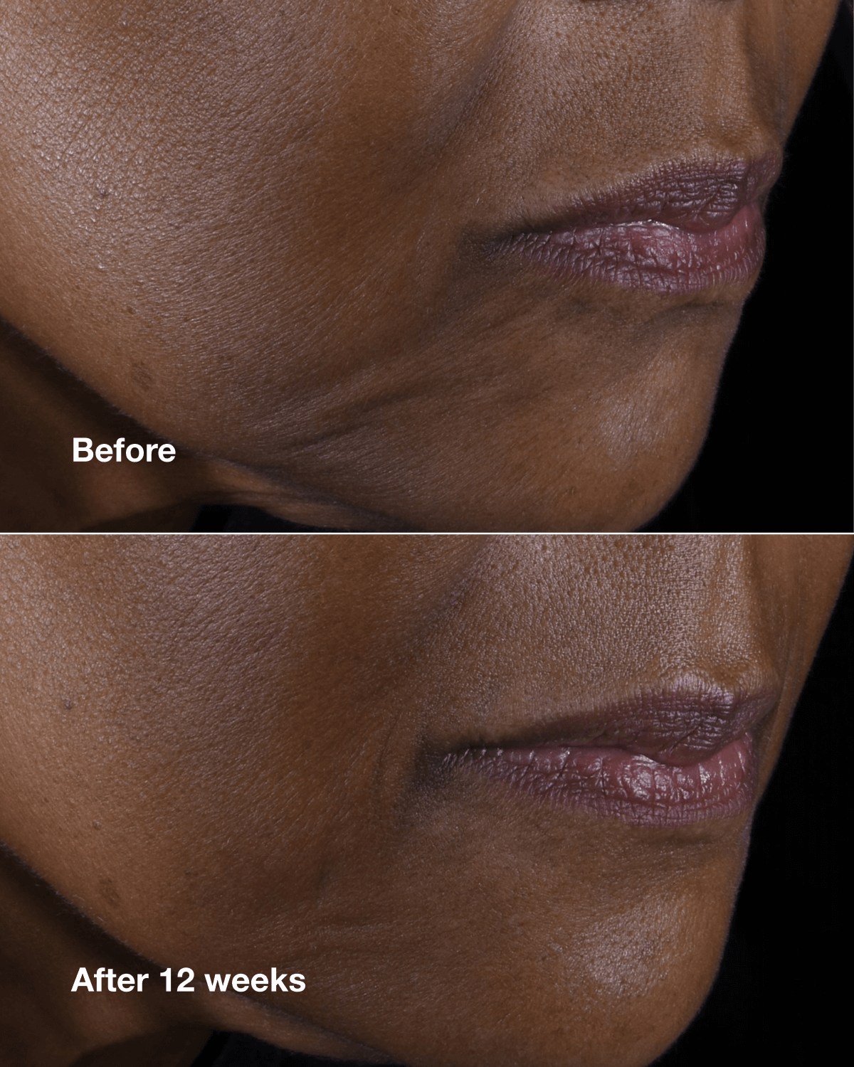 Clinique Smart Clinical Repair Lifting Face + Neck Cream 5ml