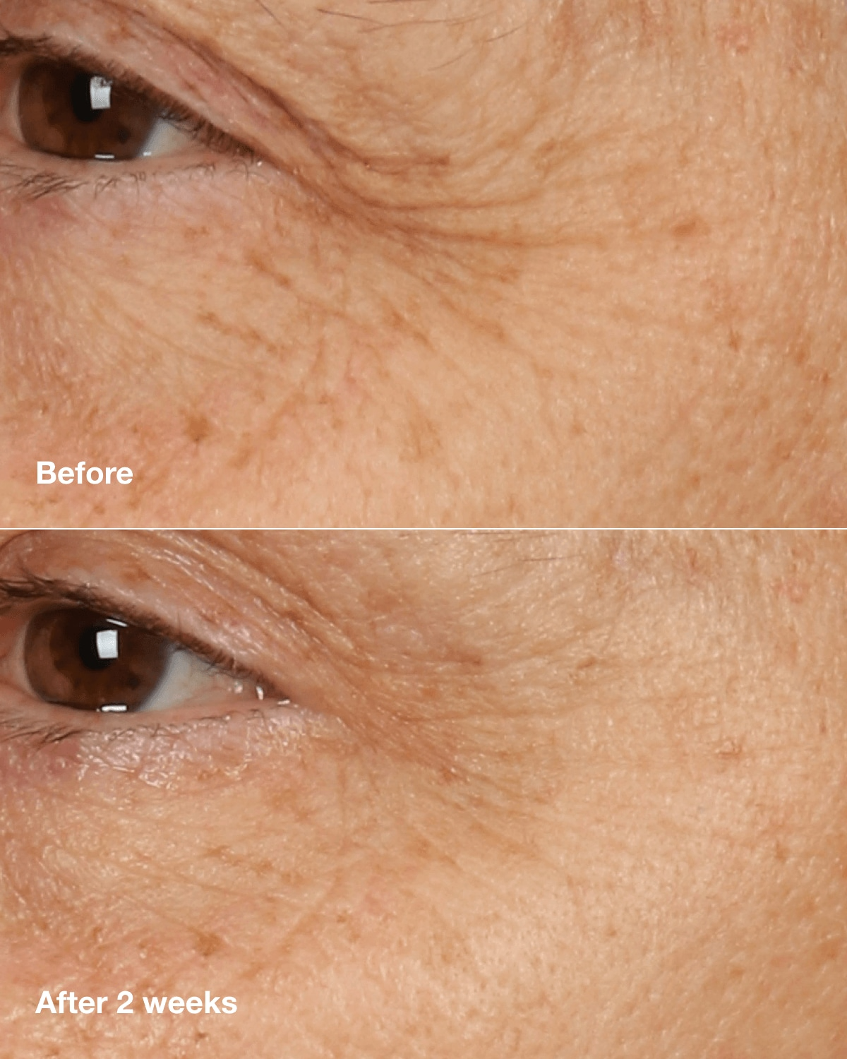 Clinique Smart Clinical Repair Overnight Recovery Face Cream 50ml