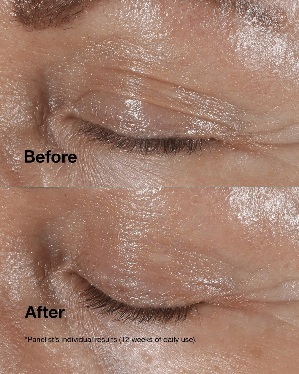 Clinique Smart Clinical Repair Wrinkle Correcting Eye Cream 30ml