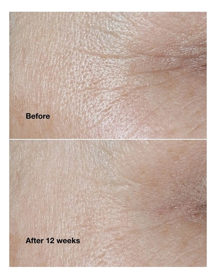 Clinique Smart Clinical Repair Wrinkle Correcting Cream 15ml