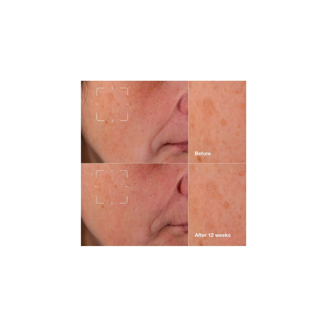 Clinique Brightening Routine 3 Piece Mini Kit